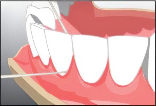 Conseils aux patients  dentaires Langon fil dentaire 3