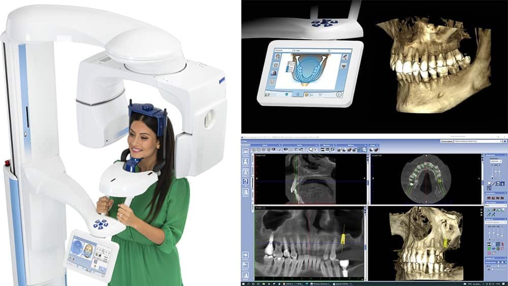 chirurgien dentiste Langon scanner panoramique